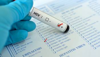WHO: Most People Have Herpes