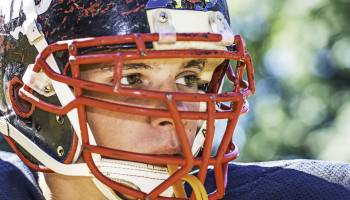 Tackling Head Injuries 