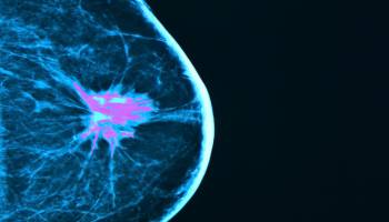 3-D Breast Cancer Screening Shows Potential