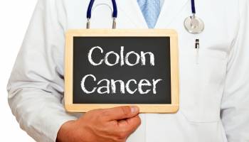 Colorectal Cancer Still Has Hot Spots