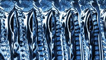 Your Spinal Cord May Have a Mind of Its Own