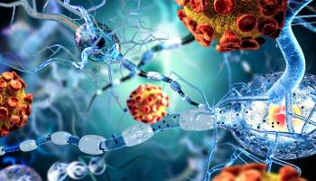 Huntington's Disease Treatments Evolving 