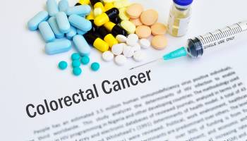 Possible Prevention Treatment for Colorectal Cancer  